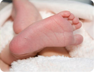 Phenylketonuria  metabolic disorder