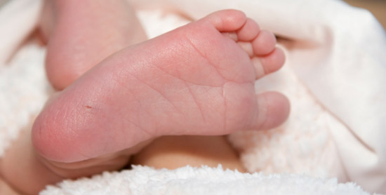 Phenylketonuria metabolic disorder Phenylketonuria metabolic